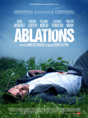 ablations aff