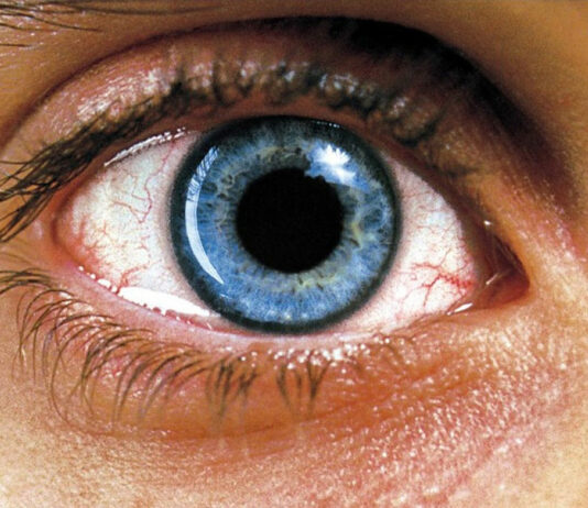 Test Blu-ray 4K Ultra HD : Requiem for a Dream